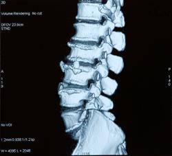 Spinal Cord X Rays