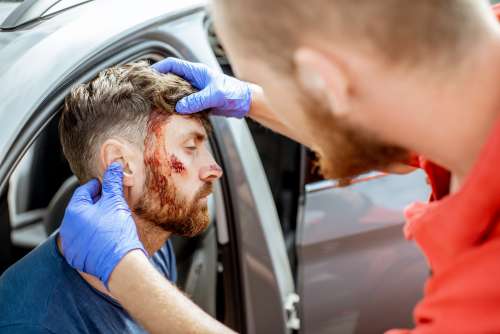 facial injury after car accident